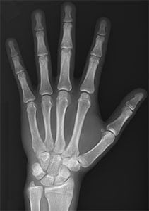 esqueleto da mão